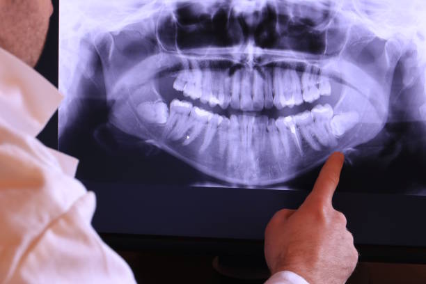 Best Emergency Denture Repair in Versailles, KY